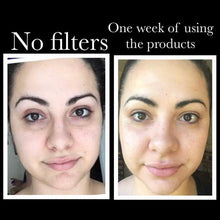 Load image into Gallery viewer, SkinSanity® Youth Restore Regimen