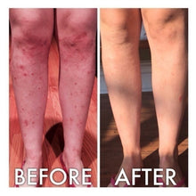 Load image into Gallery viewer, Derm #1 Dry Skin Rescue with Vitamin B3 3.38 oz
