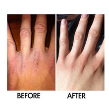 Load image into Gallery viewer, Derm #1 Dry Skin Rescue with Vitamin B3 3.38 oz
