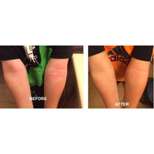 Load image into Gallery viewer, Derm #1 Dry Skin Rescue with Vitamin B3 3.38 oz
