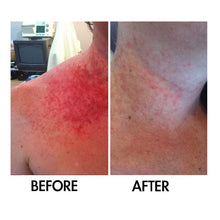 Load image into Gallery viewer, Derm #1 Dry Skin Rescue with Vitamin B3 3.38 oz
